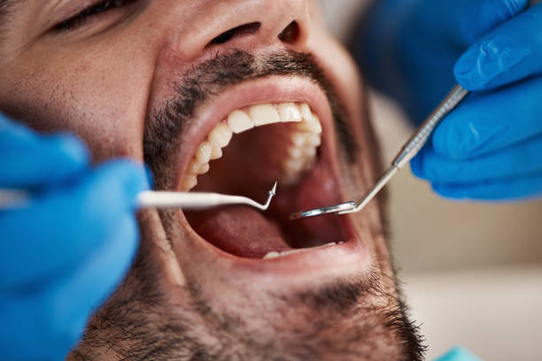 Best Same-Day Emergency Dentist in Frederick, OK