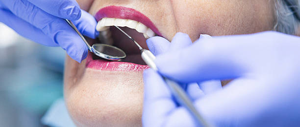 Best Emergency Wisdom Teeth Removal in Frederick, OK